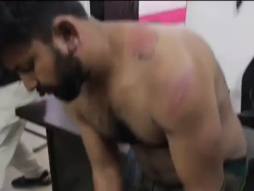   Korba,   108 ambulance ,hostage and beaten up