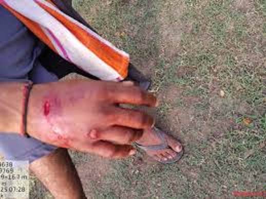 sehore,   tiger attacked , Budhni area