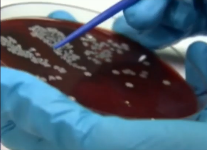  KORONA VIRUS 