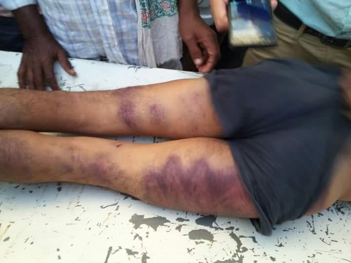 बेरहम पुलिस का खौफनाक चेहरा